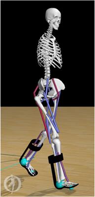 Minimization of metabolic cost of transport predicts changes in gait mechanics over a range of ankle-foot orthosis stiffnesses in individuals with bilateral plantar flexor weakness